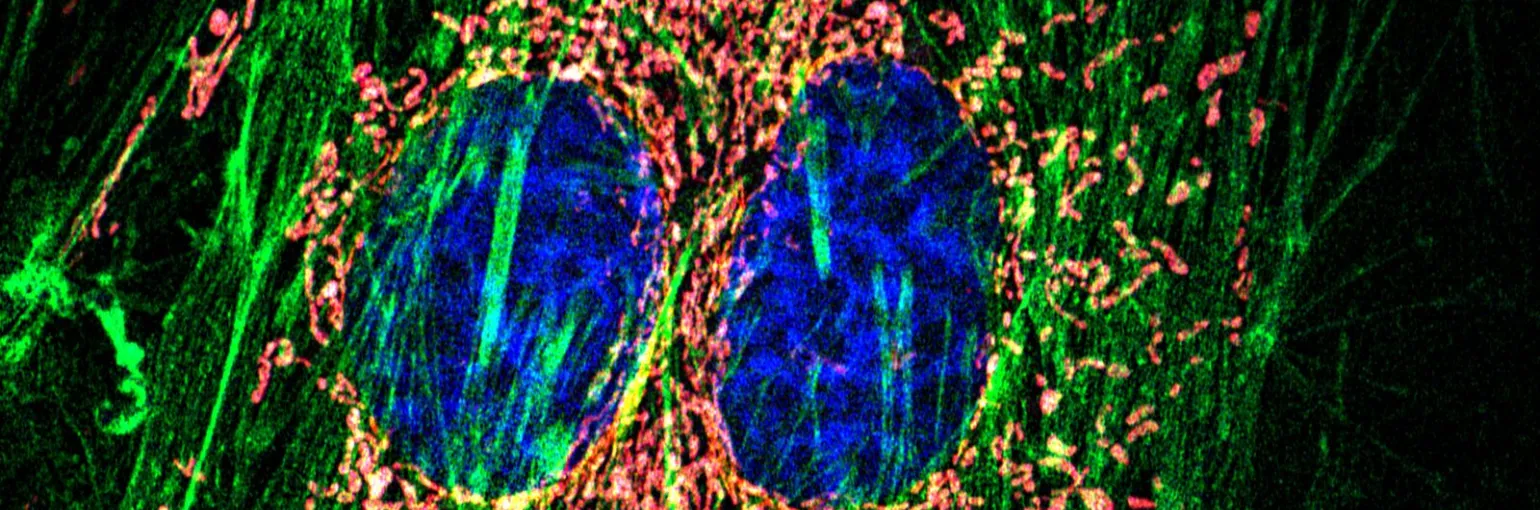HeLa cells